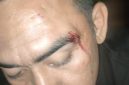 Foto: Korban dengan bekas luka di wajah