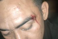 Foto: Korban dengan bekas luka di wajah