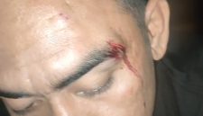 Foto: Korban dengan bekas luka di wajah