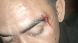 Foto: Korban dengan bekas luka di wajah