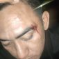 Foto: Korban dengan bekas luka di wajah
